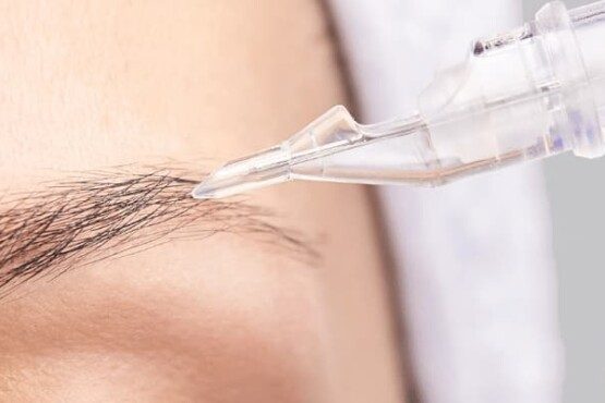 Allergie microblading